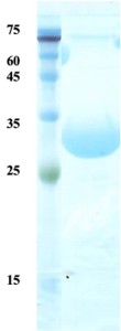 Treponema pallidum (Syphilis) p17 protein (detection)  