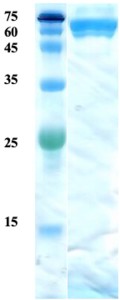 Mycobacterium tuberculosis antigen 38 protein