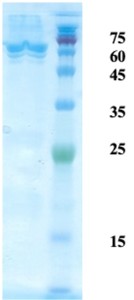 Mycobacterium tuberculosis antigen 14/16 chimeric protein