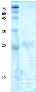 Toxoplasma gondii surface antigen (SAG) 2