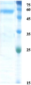 Zika NS1 protein (insect cell)
