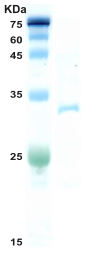 HIV-1 gag p24 protein (insect cell) HIV-1 gag p24 protein (insect cell)