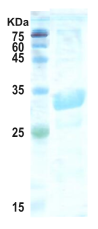 Trypanosoma cruzi chimeric chagas protein (detection)