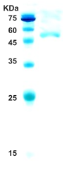 HIV-1 type O envelope gp120/gp41 protein HIV-1 type O envelope gp120/gp41 protein