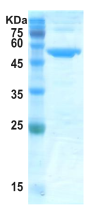 Covid-19 nucleocapsid protein