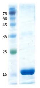 Interleukin 5 (IL-5)
