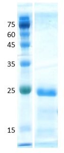 Interleukin 10 (IL-10)