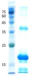Interleukin 17A (IL-17a)