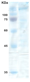 Covid-19 whole spike protein trimer (insect cell)