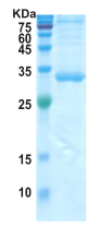 Covid-19 S-RBD + Subdomain 1 (insect cell)