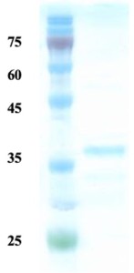 Rubella virus E1 protein