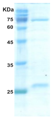 HIV-2 gag p26 protein HIV-2 gag p26 protein