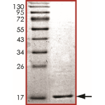 Gamma-synuclein Protein