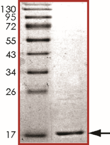 Gamma-synuclein Protein