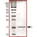 Alpha-synuclein Protein