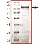 STAT1 alpha Protein