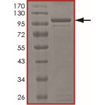 STAT1 beta Protein