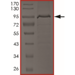 STAT5B Protein