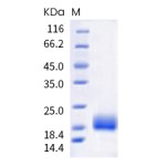 Recombinant Human TIGIT