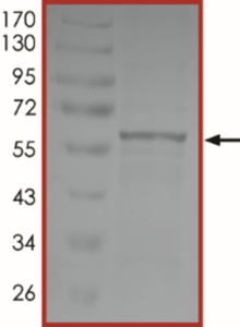 Vimentin Protein