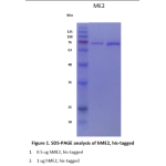 Recombinant Human Malic enzyme 2 (ME2) 