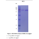 Recombinant Human Malic enzyme 2 (ME2) 