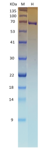 Recombinant SARS-CoV-2 Helicase (NSP13) Recombinant SARS-CoV-2 Helicase (NSP13)