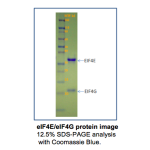 His-tagged Human Eukaryotic Translation Initiation Factor 4E Complexed With EIF4G