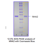 Recombinant His-tagged Human MNK2 D228G