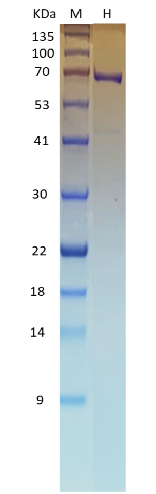 Recombinant SARS-CoV-2 Helicase (NSP13) Recombinant SARS-CoV-2 Helicase (NSP13)