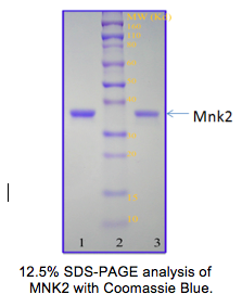 Recombinant His-tagged Human MNK2 D228G Recombinant His-tagged Human MNK2 D228G